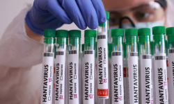Russian propaganda invents fake hantavirus 'outbreak' among Ukrainian soldiers