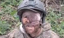Wounded Russian soldiers – some on crutches – used in ‘meat wave’ attacks